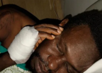 Prise en charge de Mingo (Acteur) interrompue par l’État guinéen : une cagnotte en ligne lancée…